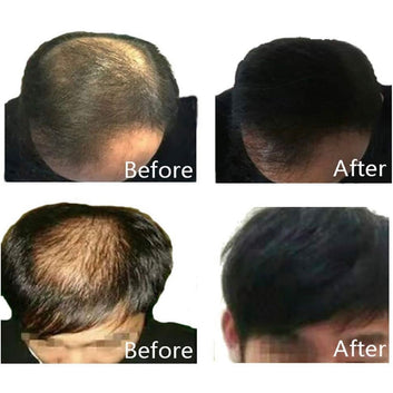 Hair Building Fibers Black 22g